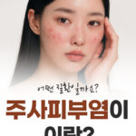 주사피부염, 얼굴이 붉어지는 이유 6