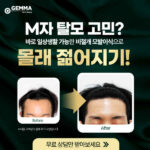 20년전 가격 그대로! 비절개 모발이식 99만원! 6