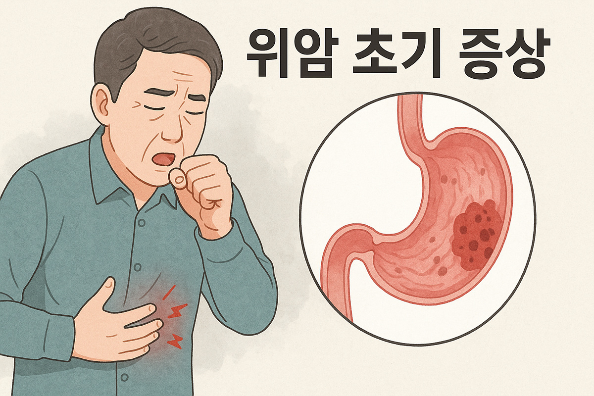 위암 초기증상, 절대 놓치면 안 되는 신호 1
