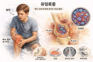 유잉육종, 뼈와 연부조직에 생기는 암 3