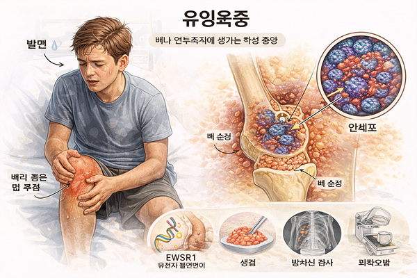 유잉육종, 뼈와 연부조직에 생기는 암 1